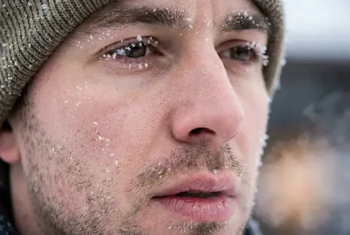 Cold Weather and Eye Effects